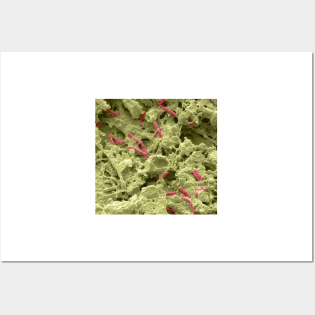 Pseudomonas lung infection, SEM (C021/7004) Wall Art by SciencePhoto